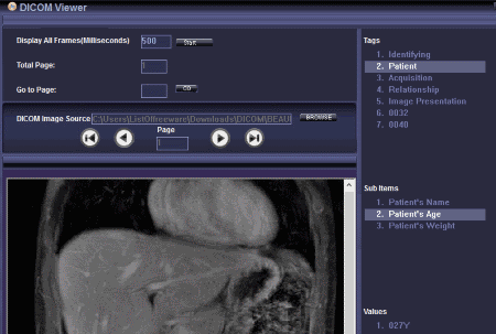 download the new version for android Lim DICOM Viewer