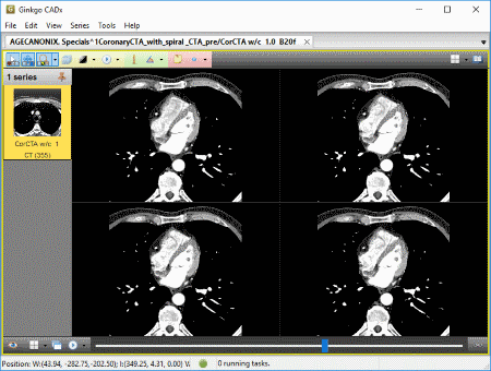 Ginkgo CADx: Best Free Windows DICOM Viewer Softwares