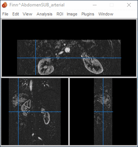 free dicom viewer download for windows 10