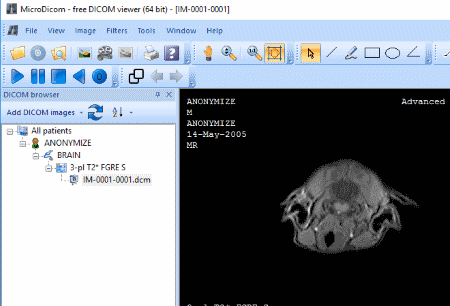 MicroDicom: Best Free Windows DICOM Viewer Softwares