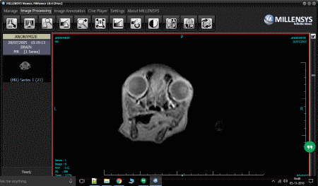 free dicom 3d viewer