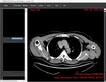 ORPALIS DICOM viewer