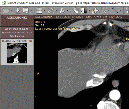 Lim DICOM Viewer free download