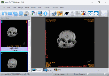 free Sante DICOM Editor 8.2.5