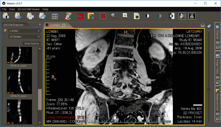 download the new version for windows Sante DICOM Viewer Pro 12.2.5